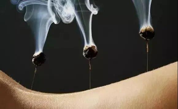 艾灸不是藥，調的不是病，央視為艾灸正名，讓我們正視艾灸