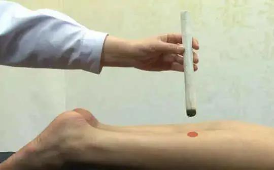 人體“消毒穴”每周艾灸4次，逼出陳年藥毒！