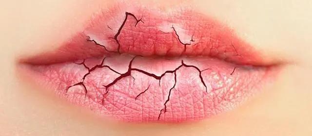嘴唇干裂，或許不是缺水，嘴唇老是干艾灸什么穴位！