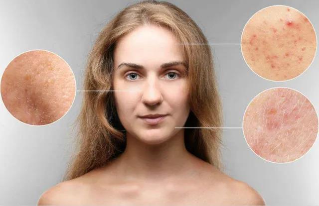 艾灸有美容效果嗎？艾灸哪里能美容