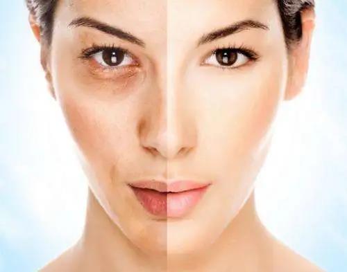 女人臉上有這“3個(gè)表現”，說(shuō)明婦科疾病“纏身”了，不要忽視了！