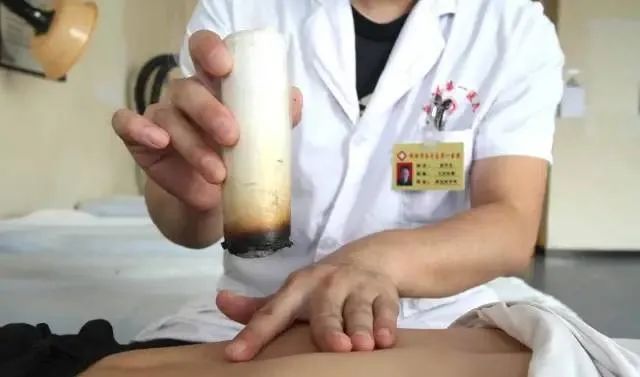 產(chǎn)后艾灸一個(gè)月，十年少生??！ 