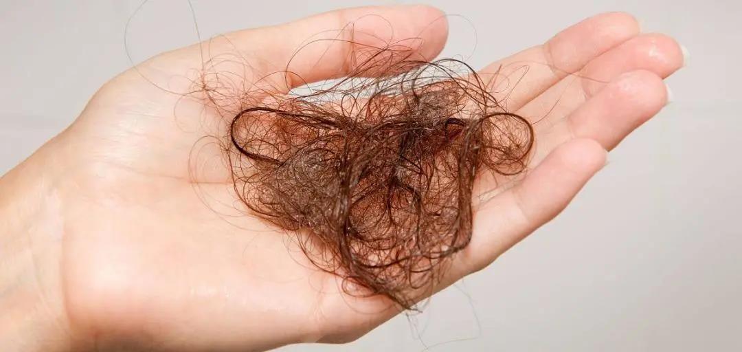 你脫的不是發(fā)，是氣血！艾灸拯救脫發(fā)危機！